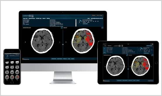 Brainomix on devices