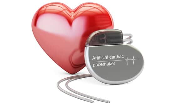 Data from implantable devices to predict heart failure risk in Manchester