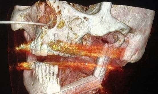 Northwick Park Hospital Reconstructive Surgery