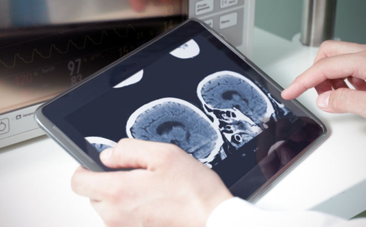 Hexarad closes £11.2m growth round for radiology platform