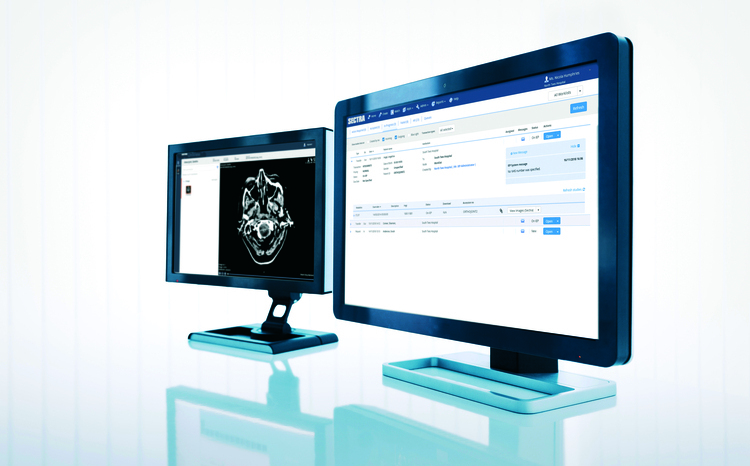 A pair of computer monitors displaying medical imaging software: the left screen shows a scan of a brain, while the right screen displays a patient information and imaging portal interface.